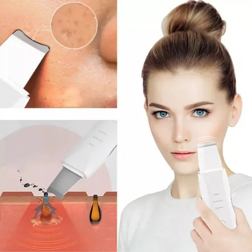 Limpiador Facial Ultrasonico